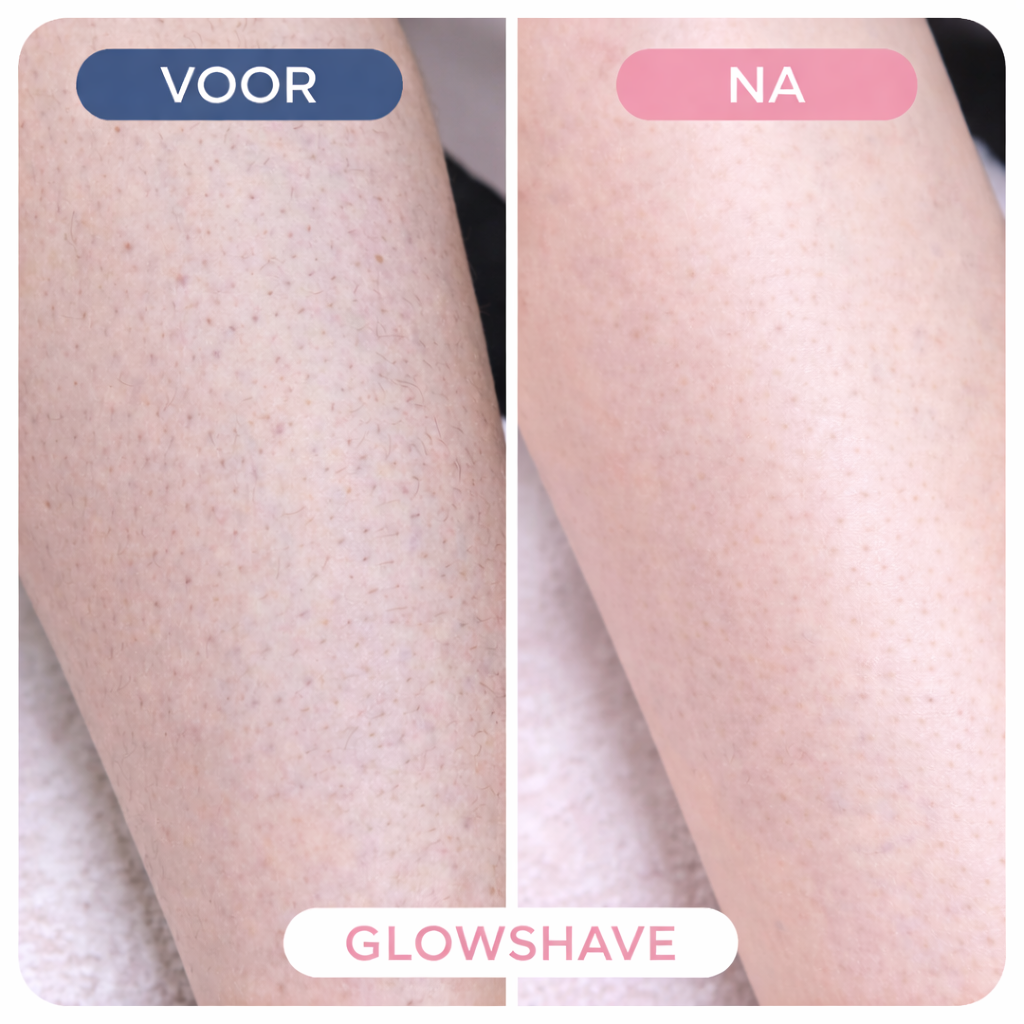 Auracure™ Glowshave 2-in-1