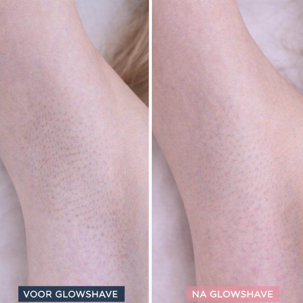 Auracure™ Glowshave 2-in-1